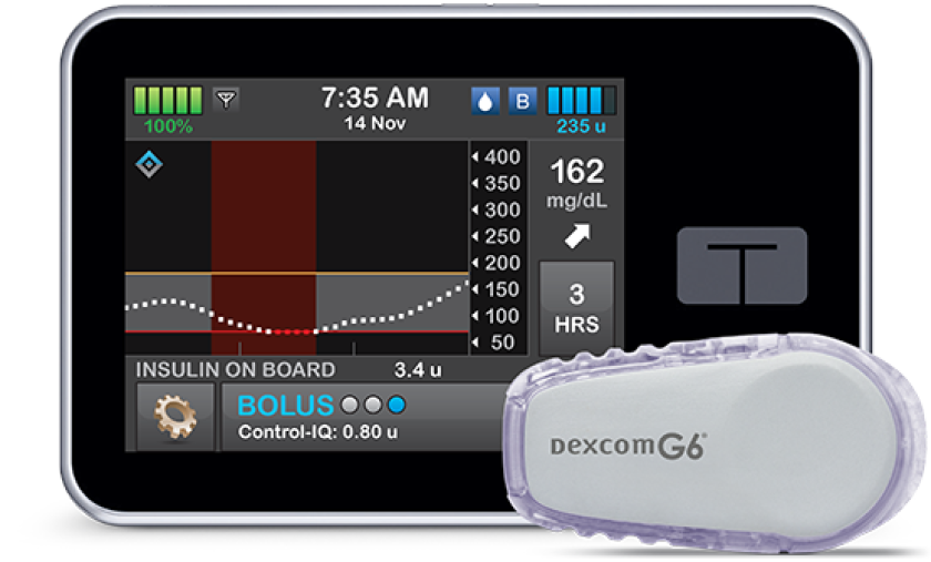 tandem_insulin_pump.png