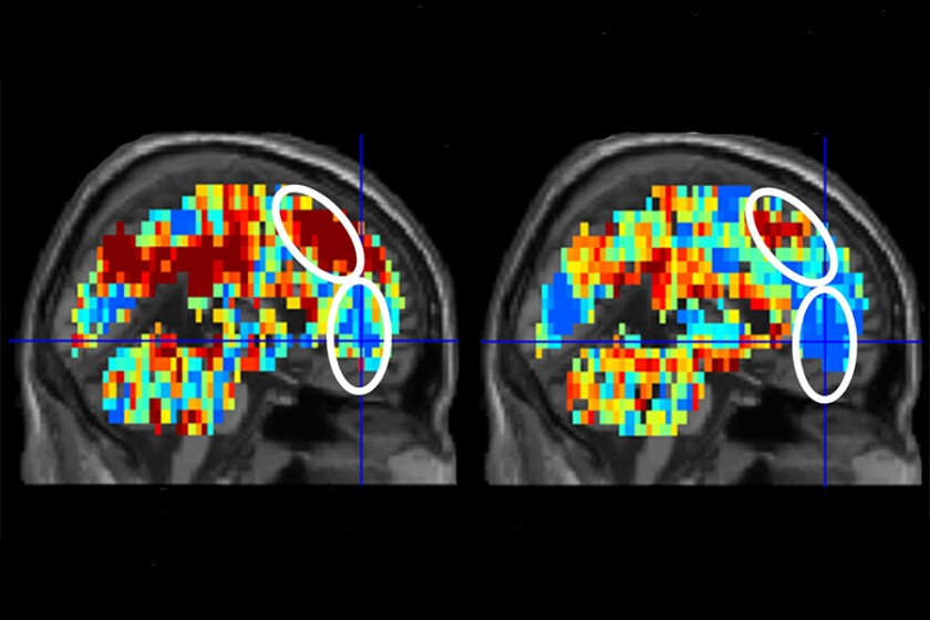 Imaging Suicide-CROP.jpg