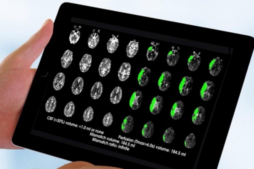 Brain Image-CROP.jpg