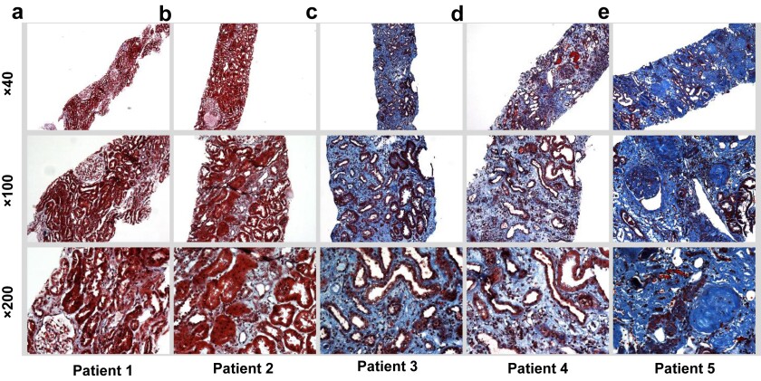 digital pathology.jpg