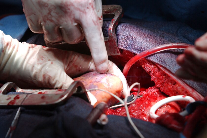 Surgery-CROP-2.jpg