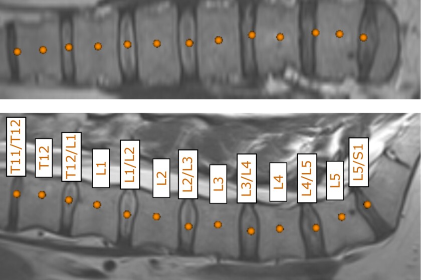 spine073118-CROP copy.jpg