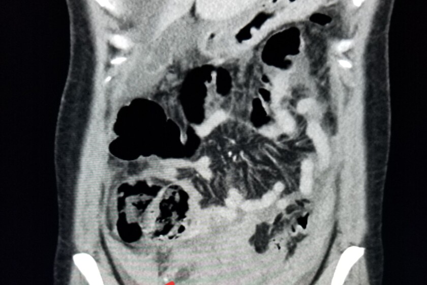 CT-pregnancy-CROP.jpg