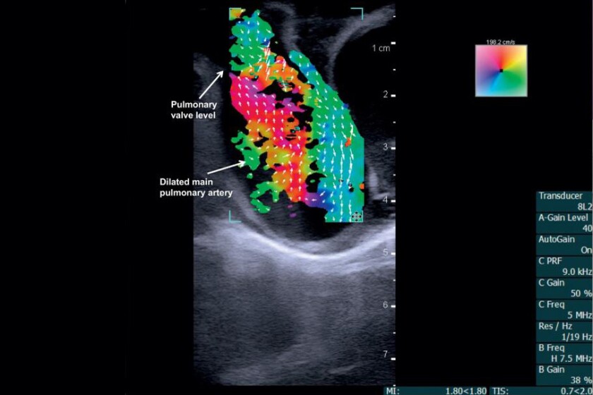 Vector flow imaging-CROP.jpg