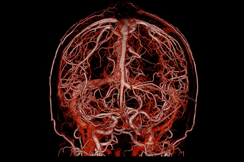 Ultra-High-CT-CROP.jpg
