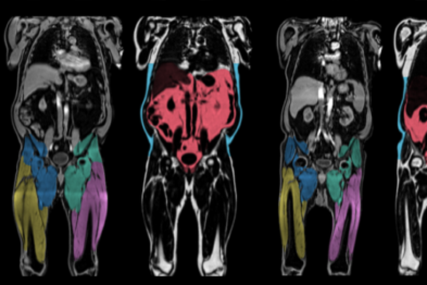 body-4-e1517403755461-CROP.png