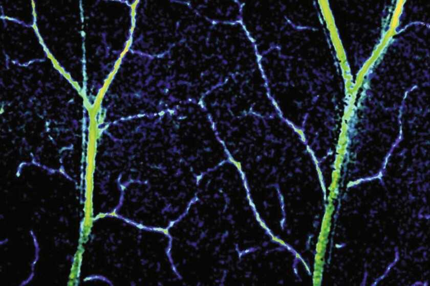 Capillaries-CROP.jpg