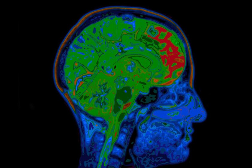 Brain scan-CROP.jpg