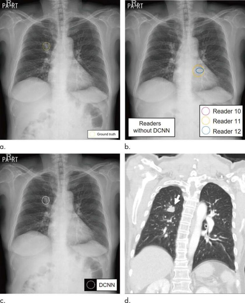Chest xrays.jpg