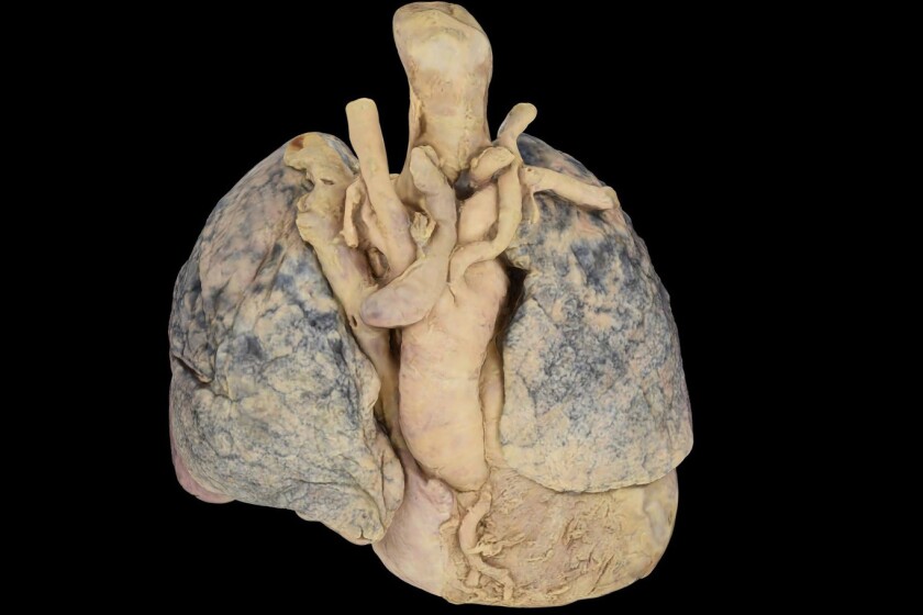 Anatomage-lungs-CROP.jpg