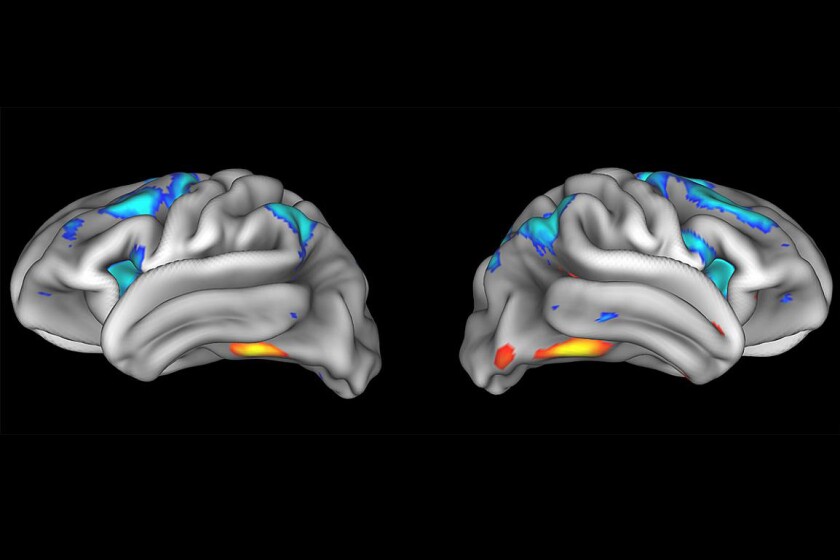 brain-nida-CROP.jpg